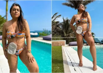 Preta Gil exibe bolsa de ileostomia ao posar de lingerie: “Não tenho vergonha”
