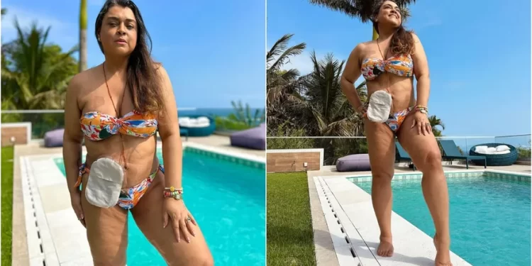 Preta Gil exibe bolsa de ileostomia ao posar de lingerie: “Não tenho vergonha”